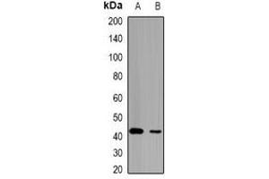 Western blot analysis of HCCR-1 expression in mouse kidney (A), mouse liver (B) whole cell lysates.