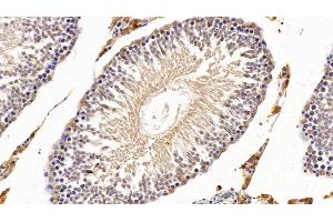 Immunohistochemistry (IHC) image for anti-Cytochrome P450, Family 1, Subfamily A, Polypeptide 1 (CYP1A1) (AA 251-521) antibody (ABIN7441016)