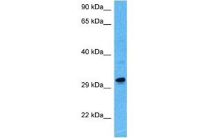 Host:  Rat  Target Name:  MAFB  Sample Tissue:  Rat Skeletal Muscle  Antibody Dilution:  1ug/ml (MAFB Antikörper  (N-Term))