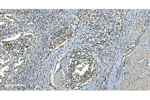 anti-N(alpha)-Acetyltransferase 38, NatC Auxiliary Subunit (NAA38) (AA 1-96) antibody