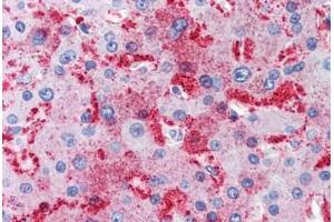 Human Liver (formalin-fixed, paraffin-embedded) stained with MUC13 antibody ABIN351431 at 10 ug/ul followed by biotinylated goat anti-rabbit IgG secondary antibody ABIN481713, alkaline phosphatase-streptavidin and chromogen. (MUC13 Antikörper  (Internal Region))