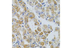 Immunohistochemistry of paraffin-embedded human stomach using PCSK9 antibody (ABIN5975791) at dilution of 1/100 (40x lens). (PCSK9 Antikörper)