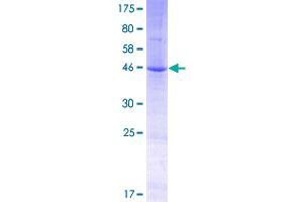 TM2D3 Protein (AA 1-221) (GST tag)