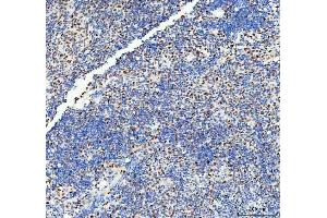 IHC analysis of DDX1 using anti-DDX1 antibody (ABIN7602050).