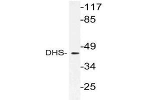 Western blot (WB) analysis of DHS antibody in extracts from 3T3 cells. (DHPS Antikörper)