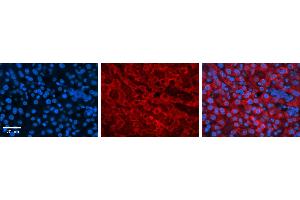 DHODH antibody - C-terminal region          Formalin Fixed Paraffin Embedded Tissue:  Human Liver Tissue    Observed Staining:  Cytoplasm in hepatocytes   Primary Antibody Concentration:  1:100    Secondary Antibody:  Donkey anti-Rabbit-Cy3    Secondary Antibody Concentration:  1:200    Magnification:  20X    Exposure Time:  0. (DHODH Antikörper  (C-Term))