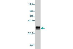 Western Blot detection against Immunogen (36. (Growth Hormone Receptor Antikörper  (AA 19-118))