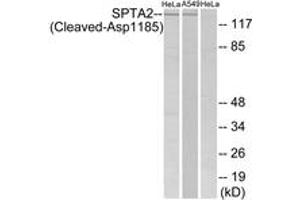 Western blot analysis of extracts from HeLa/A549 cells, treated with etoposide 25uM 24H, using SPTA2 (Cleaved-Asp1185) Antibody. (SPTAN1 Antikörper  (Cleaved-Asp1185))