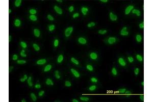 Image no. 2 for anti-YY1 Transcription Factor (YY1) (AA 221-321) antibody (ABIN599012) (YY1 Antikörper  (AA 221-321))