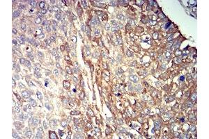 Immunohistochemistry (IHC) image for anti-Purinergic Receptor P2Y, G-Protein Coupled, 14 (P2RY14) antibody (ABIN5611336)