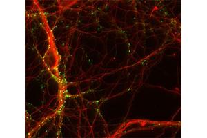 Immunocytochemistry (ICC) image for anti-Tubulin, beta 3 (TUBB3) (AA 443-450) antibody (ABIN1742554) (TUBB3 Antikörper  (AA 443-450))