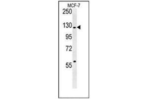 Western blot analysis of RABGAP1 Antibody (N-term) in MCF-7 cell line lysates (35ug/lane). (RABGAP1 Antikörper  (N-Term))