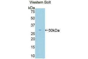 Western blot analysis of the recombinant protein. (EIF2AK2 Antikörper  (AA 279-506))