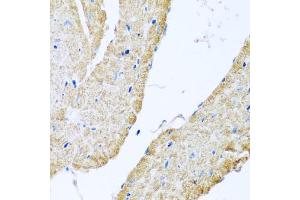 Immunohistochemistry of paraffin-embedded mouse heart using COX6B1 antibody (ABIN5974626) at dilution of 1/100 (40x lens). (COX6B1 Antikörper)