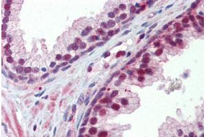Immunohistochemistry (Paraffin-embedded Sections) (IHC (p)) image for anti-Nuclear Receptor Subfamily 0, Group B, Member 2 (NR0B2) (AA 110-159) antibody (ABIN6741607)