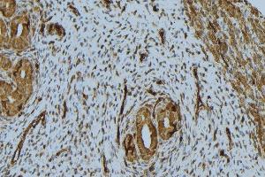 ABIN6276760 at 1/100 staining Human uterus tissue by IHC-P. (NPPA Antikörper  (C-Term))