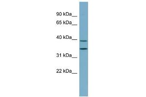WB Suggested Anti-PRKAB1 Antibody Titration: 0. (PRKAB1 Antikörper  (N-Term))