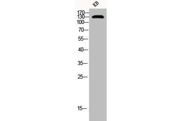 INPP5D Antikörper  (pTyr1021)