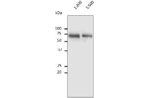 Anti-Albumin Ab at 1/2,500 dilution, 10 µl of diluted human serum per Iane, Rabbit polyclonal to goat IgG (HRP) at 1/10,000 dilution, (Albumin Antikörper)