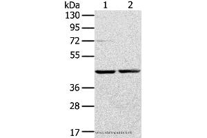 Western blot analysis of Hepg2 and hela cell, using RRAGA Polyclonal Antibody at dilution of 1:400 (RRAGA Antikörper)