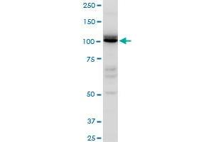 IDE polyclonal antibody (A01), Lot # ABNOVA060711QCS1.