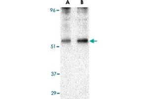 Western blot analysis of PLIN3 in EL4 cell lysate with PLIN3 polyclonal antibody  at (A) 0. (PLIN3 Antikörper  (N-Term))