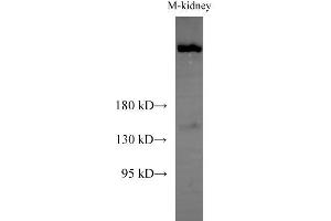 Western Blot analysis of Mouse kidney using Sptan1 Polyclonal Antibody at dilution of 1:1000 (SPTAN1 Antikörper)