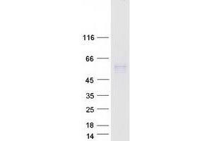 Western Blotting (WB) image for Phospholipid Transfer Protein (PLTP) (Transcript Variant 2) protein (Myc-DYKDDDDK Tag) (ABIN2729197)