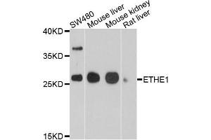 Western blot analysis of extracts of various cells, using ETHE1 antibody. (ETHE1 Antikörper)