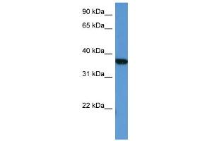 WB Suggested Anti-MAPKAPK2 Antibody Titration: 0. (MAPKAP Kinase 2 Antikörper  (Middle Region))