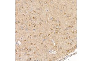 Immunohistochemistry (IHC) image for anti-Regulator of Calcineurin 1 (RCAN1) (AA 60-245) antibody (ABIN6146811)