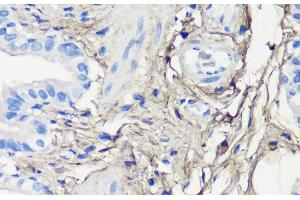 Immunohistochemistry of paraffin-embedded Rat lung using Decorin Polyclonal Antibody at dilution of 1:200 (40x lens). (Decorin Antikörper)
