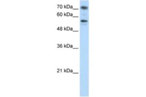 Western Blotting (WB) image for anti-Bromodomain Containing 7 (BRD7) antibody (ABIN2461841)