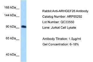 WB Suggested Anti-ARHGEF26 Antibody Titration: 0. (SGEF Antikörper  (N-Term))