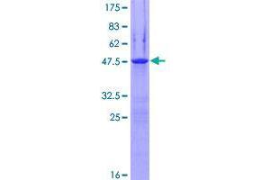 Image no. 1 for Epsin 3 (EPN3) (AA 1-208) protein (GST tag) (ABIN1352971) (EPN3 Protein (AA 1-208) (GST tag))