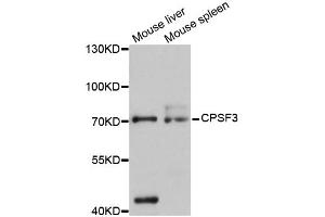 Western blot analysis of extracts of various cell lines, using CPSF3 antibody (ABIN5997506) at 1:3000 dilution. (CPSF3 Antikörper)