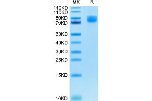 CD86 Protein (CD86) (AA 26-247) (Fc Tag)