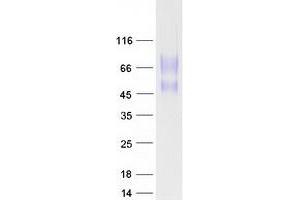 Western Blotting (WB) image for CD164 (CD164) (Transcript Variant 1) protein (Myc-DYKDDDDK Tag) (ABIN2713451)
