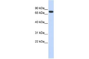 WB Suggested Anti-ANKRD13B Antibody Titration: 0. (ANKRD13B Antikörper  (Middle Region))