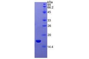 Image no. 1 for Sema Domain, Immunoglobulin Domain (Ig), Short Basic Domain, Secreted, (Semaphorin) 3A (SEMA3A) (AA 31-141) (Active) protein (His tag) (ABIN5665901) (SEMA3A Protein (AA 31-141) (His tag))