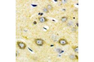 Immunohistochemistry (IHC) image for anti-Cytochrome P450, Family 2, Subfamily W, Polypeptide 1 (CYP2W1) antibody (ABIN7302782)