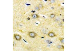 Immunohistochemical analysis of Cytochrome P450 2W1 staining in human brain formalin fixed paraffin embedded tissue section. (CYP2W1 Antikörper)