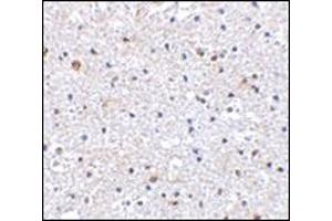 Immunohistochemistry of PD-1 in Human brain tissue with AP30650PU-N PD1 antibody at 2. (PD-1 Antikörper  (C-Term))