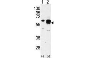 Western blot analysis of CAMK1G (arrow) using rabbit polyclonal CAMK1G Antibody (C-term) . (CAMK1G Antikörper  (C-Term))