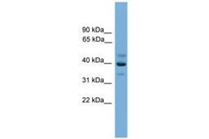 Image no. 1 for anti-BCL2/adenovirus E1B 19kD Interacting Protein Like (BNIPL) (AA 251-300) antibody (ABIN6746355) (BNIPL Antikörper  (AA 251-300))
