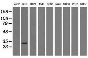 Image no. 2 for anti-Glutathione S-Transferase theta 2 (GSTT2) antibody (ABIN1498558) (GSTT2 Antikörper)