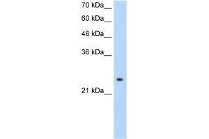 WB Suggested Anti-ADH6 Antibody Titration:  1. (ADH6 Antikörper  (Middle Region))