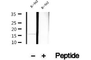Western blot analysis of extracts of K-562 cells, using Hemoglobin epsilon antibody. (Hemoglobin, epsilon 1 (HBe1) Antikörper)