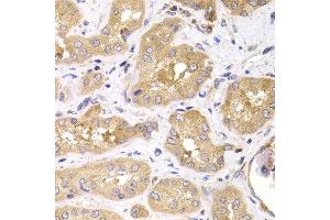 Immunohistochemistry of paraffin-embedded human kidney using RPS4X antibody at dilution of 1:100 (x400 lens).