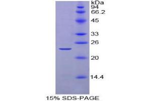 SDS-PAGE analysis of Chicken Noggin Protein.
